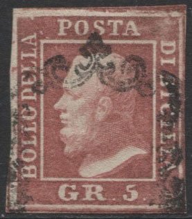 155